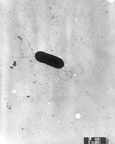 <em>Listeria monocytogenes</em>