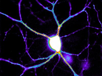 Colorful New Era of Calcium Imaging (1 of 3)