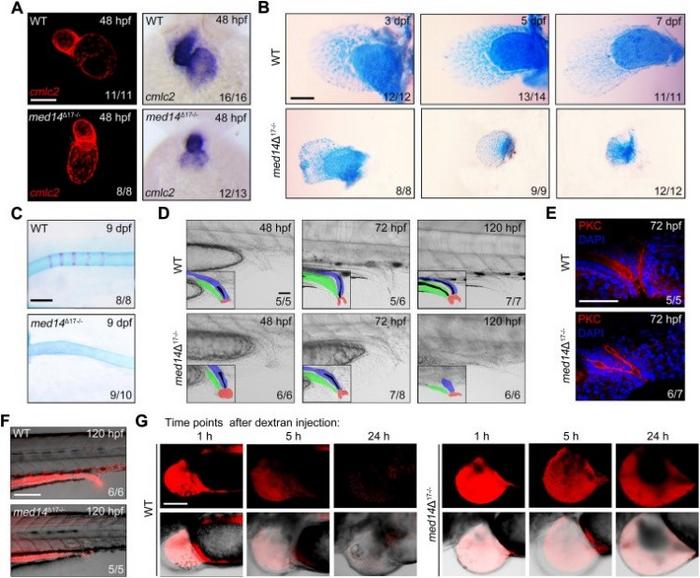 Zebrafish med14 mutant recapitulates the phenotypes of VACTERL association.