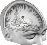 Brain Regions Out-Of-Body Illusion