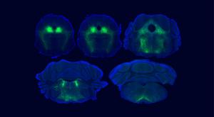Key Brain Circuit