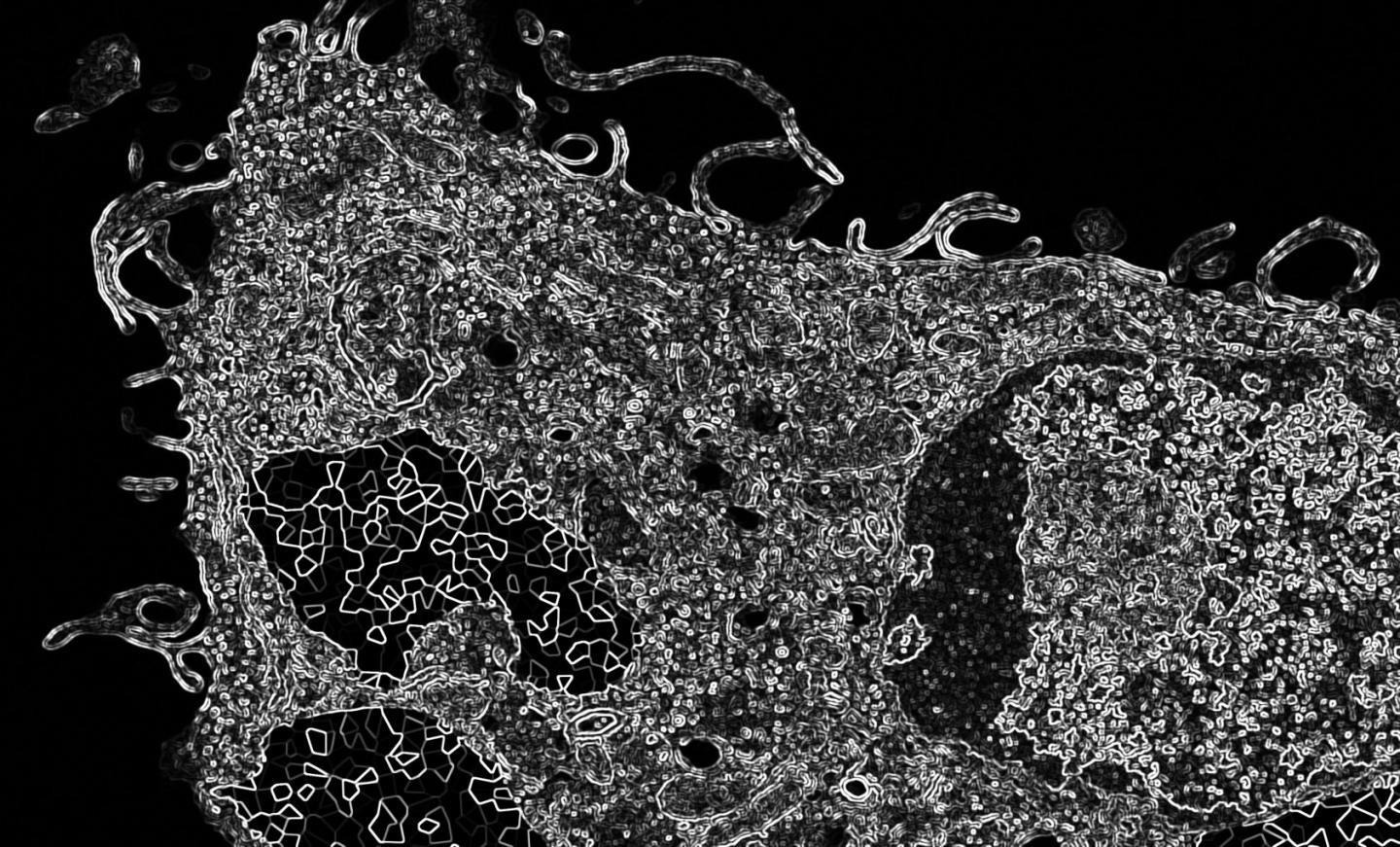 Hemozoin-Containing Macrophage