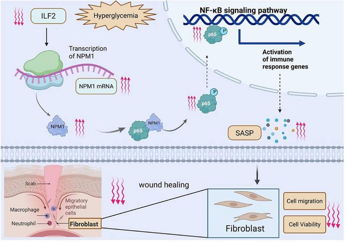 Schematic illustration of the proposed ILF2–NPM1–NF-κB regulatory axis in diabetic foot ulcer wound healing.