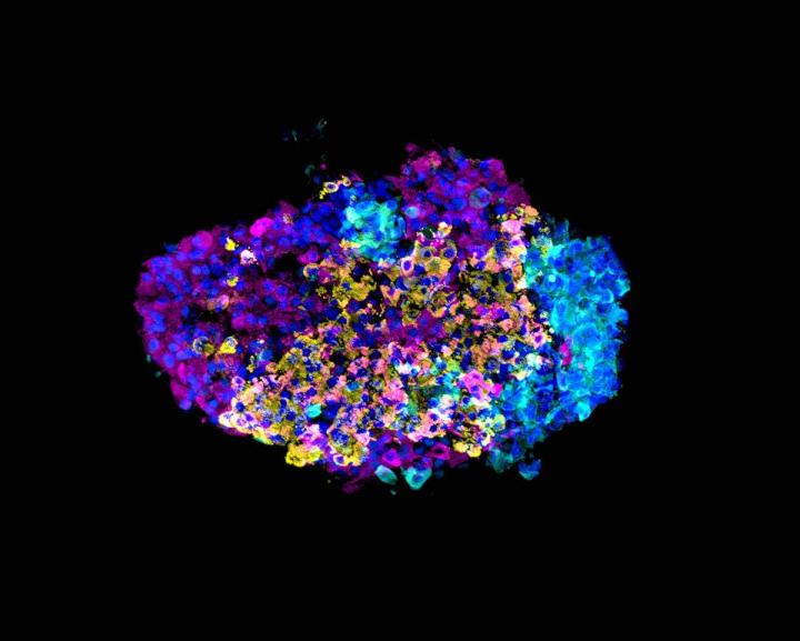 Beta Cell Cluster Before Enrichment Process