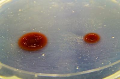 Bacteria