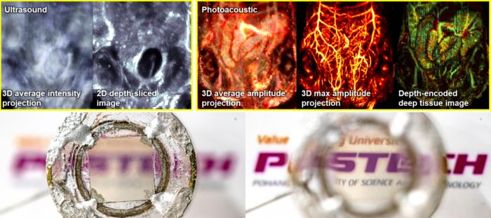 Ultrasound-photoacoustic dual modal imaging of TUT and mouse abdomen