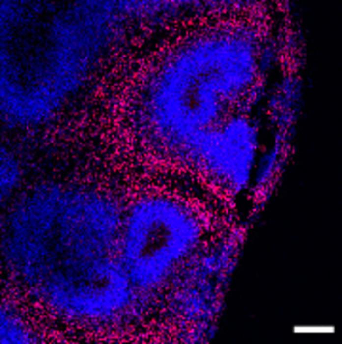 A new study exemplifies how brain organoids can be used to identify potential AD-specific intervention targets