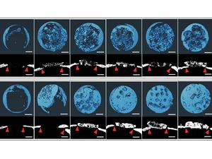 Bone tissue bioprinting body photo