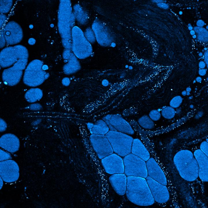 Vesicle Visualization in Breast Cancer Tissue