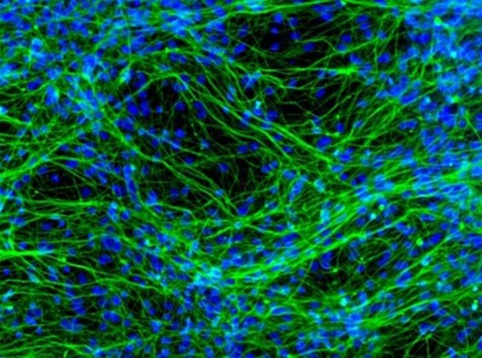 Study reveals specific neuronal circuits and therapeutic mechanisms of delta opioid receptors in anxiety-like behavior