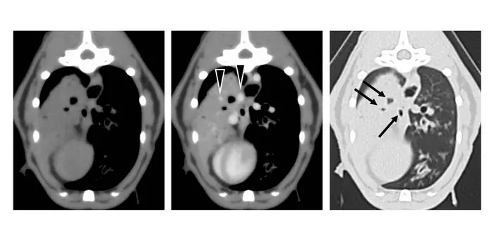 CT of pulmonary lymphoma