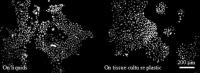 Epidermal Cell Colonies Grown On Liquids (Left) and Tissue Culture Plastic Classically Used For Cell