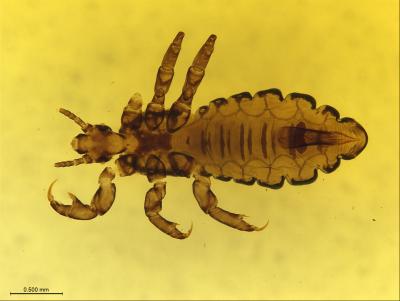 Body Louse