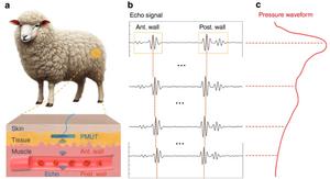 Illustration and principle of the subcutaneous and continuous BP monitoring by PMUTs in an ambulatory sheep.