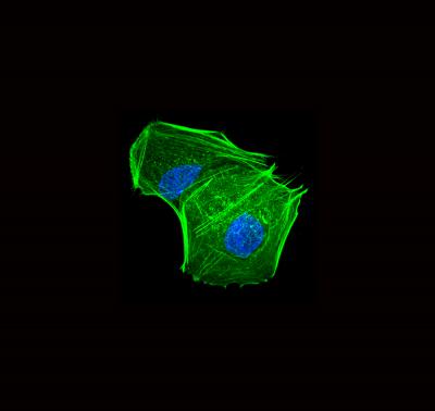 Neuroblastoma Cell After Treatment