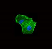 Neuroblastoma Cell After Treatment