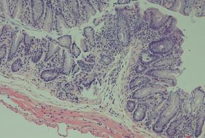 Standard tissue staining of a mouse intestine demonstrating robust inflammation in the absence of ILC3-specific STING.