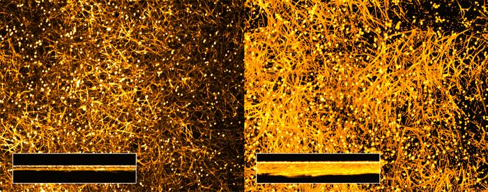 Albumin triggers fungal virulence