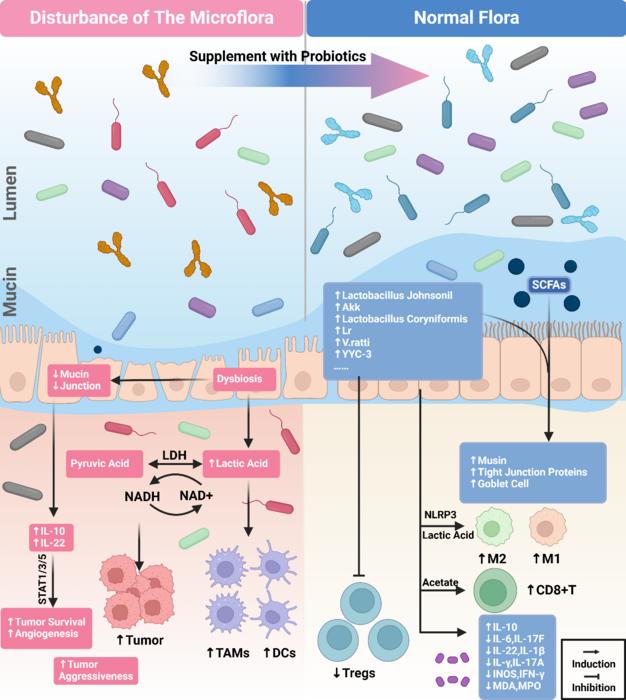 Influence of intestinal microbiota on tumor microenvironment.