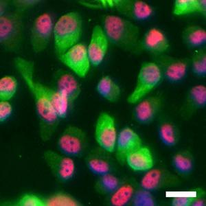 WWOX Expression Correlates with Elevated p63 Levels in Skin Cancer Cells