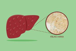Assessing liver fibrosis through plasma fibulin-5