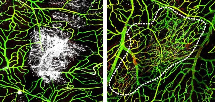 Watching the Brain's Lining Get Repaired in Mice