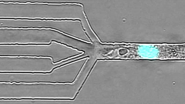 A Leukocyte In A Collagen Maze