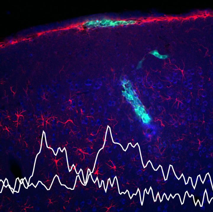 CNiFERs Implanted in Mouse Brain