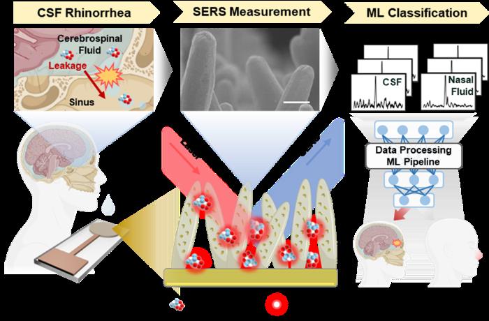 Schematic illustration of the development of the AI-based CSF leakage diagnostic platform