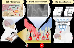 Schematic illustration of the development of the AI-based CSF leakage diagnostic platform