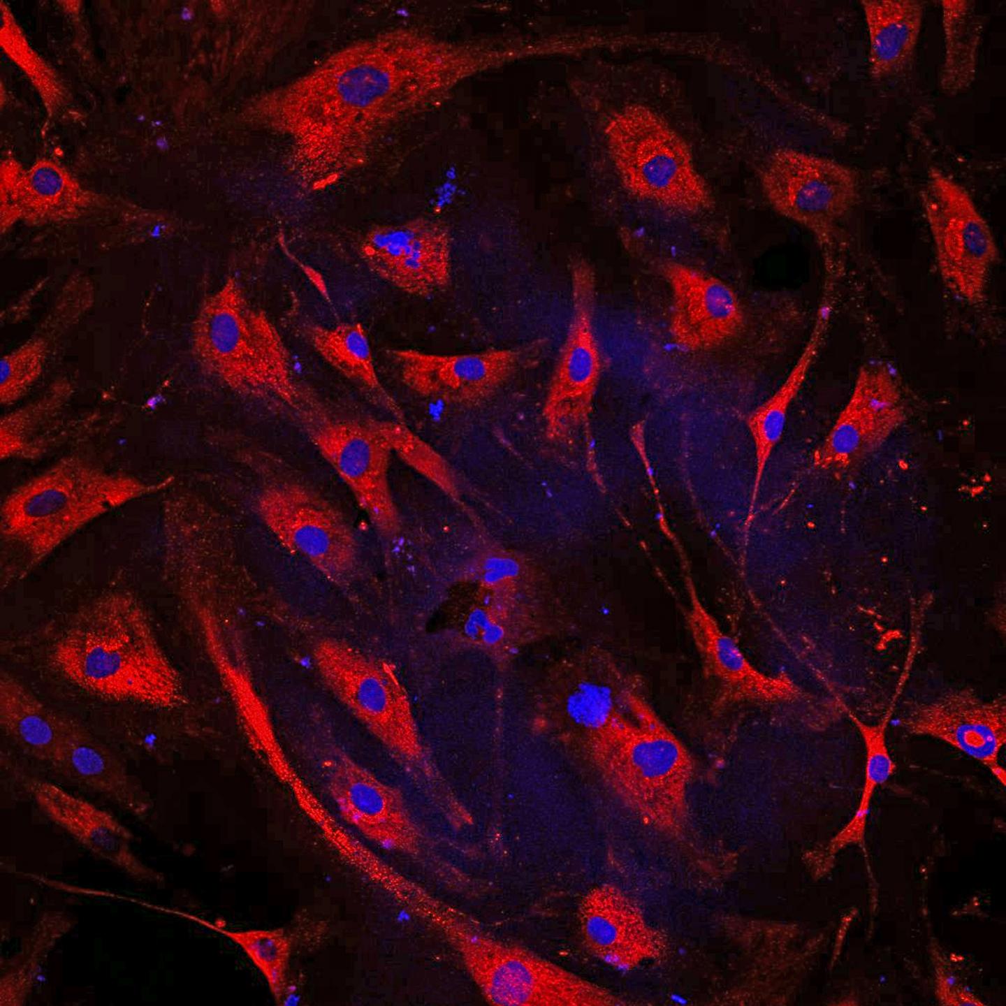 Treated Heart Cells