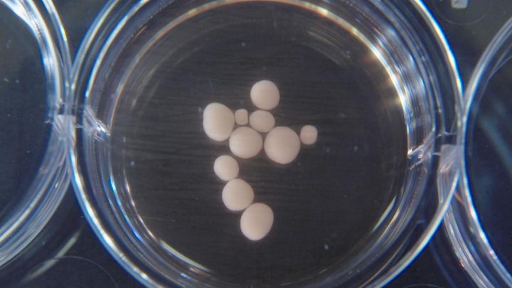 Brain Organoids
