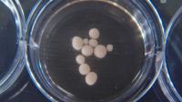 Brain Organoids