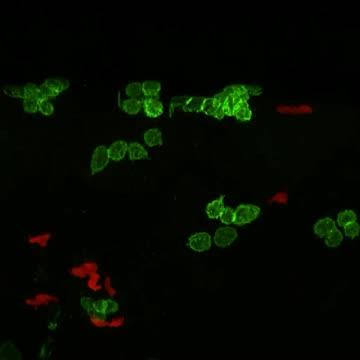 How Wounds Healing Influences Cancer