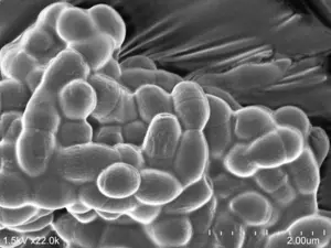 Culture of Streptococcus pneumoniae untreated with bacteriocins from Streptococcus mitis.