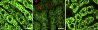 Liver Regeneration