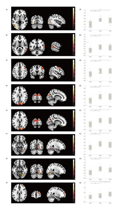 Spatial distributions and quantitative analyses of seed-based functional connectivity (FC) among three conditions