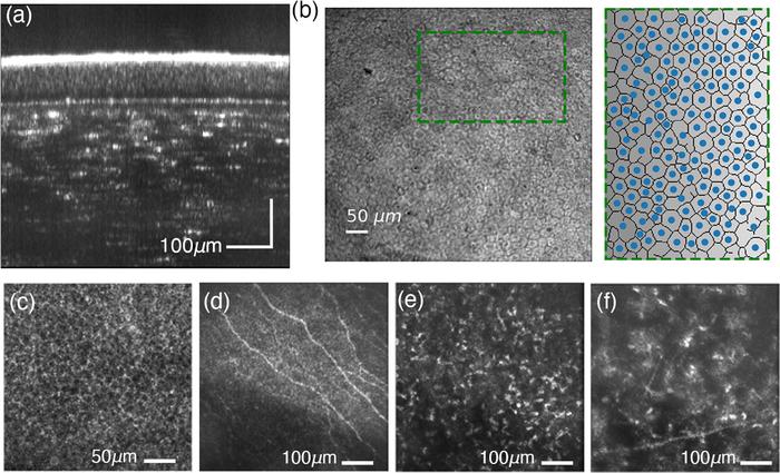 STOC-T imaging of the human cornea. The technique makes it possible to visualize different layers of the cornea, including cells and nerve structures