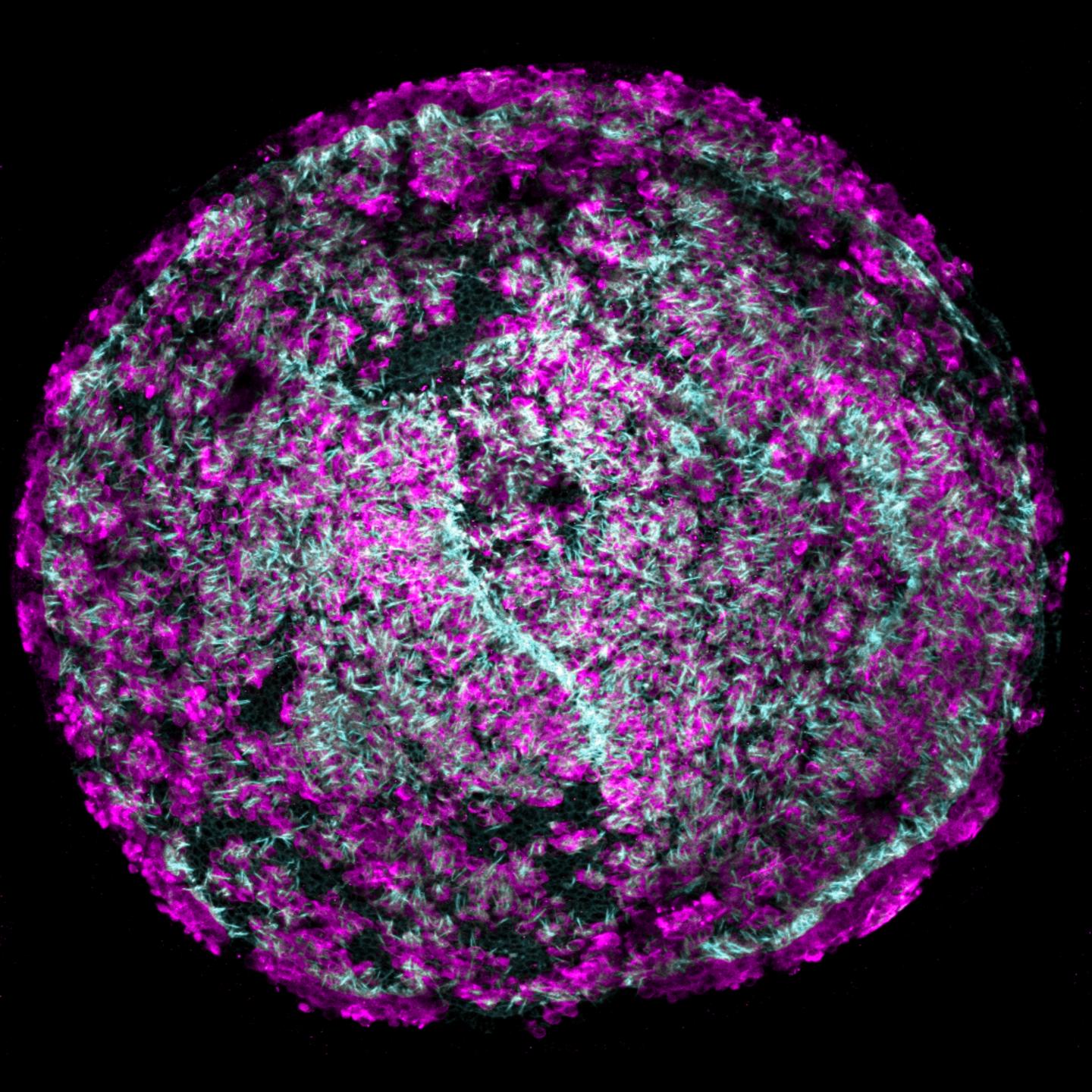 Researchers Discover a Drug Combination that Can Regenerate Hair Cells