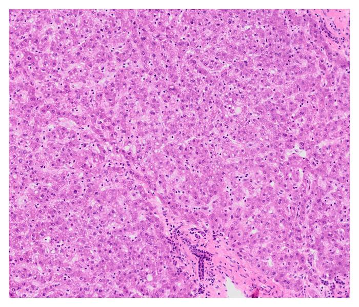 Histological image of a liver sample