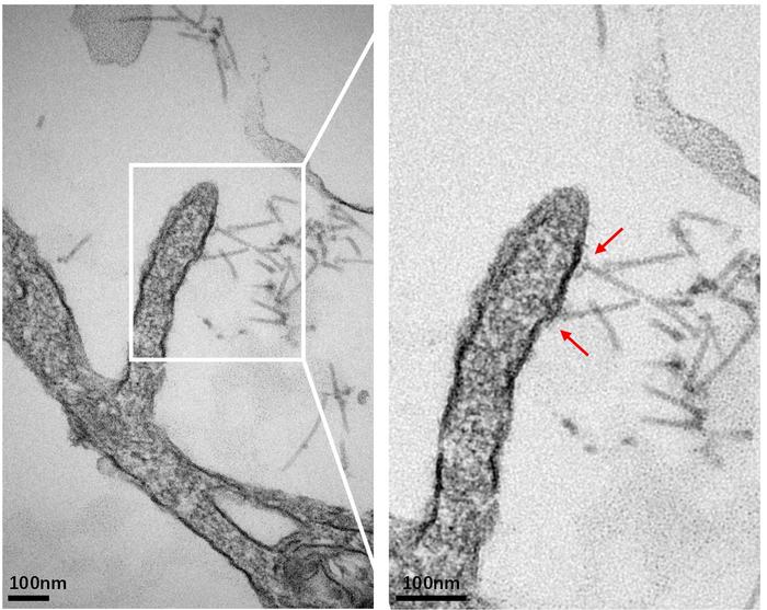 Transmission electron microscope images of eCIS particles purified from bacteria.
