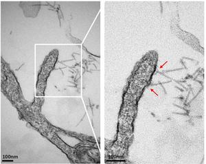 Transmission electron microscope images of eCIS particles purified from bacteria.