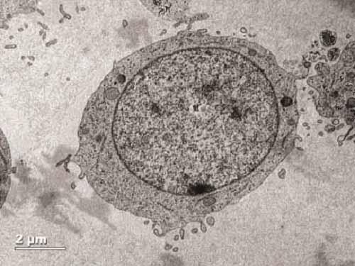 Cells Without CD34