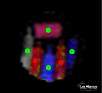 MRI of Bottles