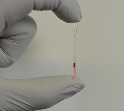 Positive Test (1 of 2)