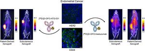 New Theranostic Targets Identified for Diagnosis and Treatment of Endometrial Cancer