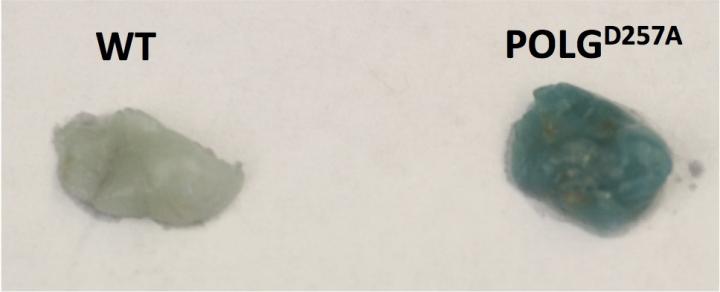 Fat Biopsies Stained for Senescence