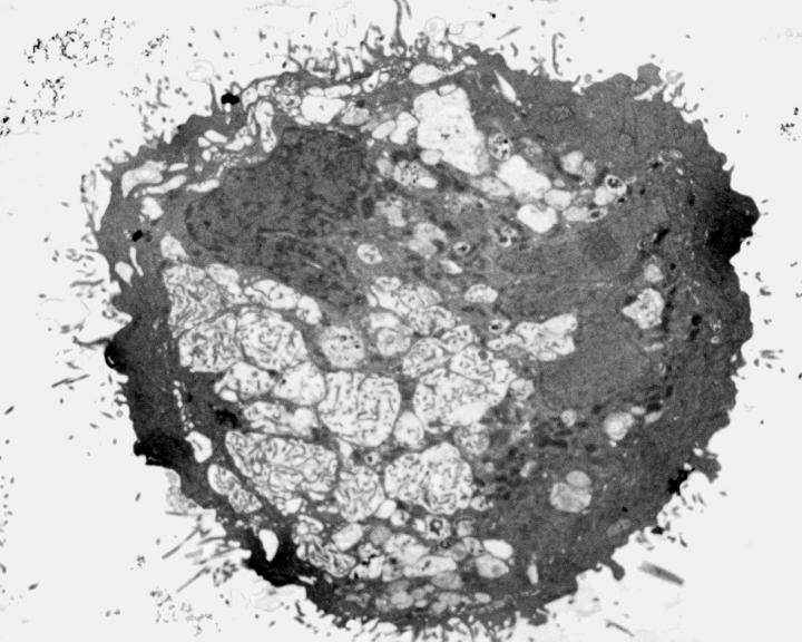 Disrupting the Metabolism of Brain Cancer Cells (1 of 2)