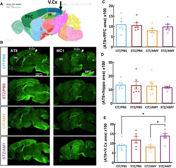 Immunostaining for p-tau in the brains of PS19 mice injected with CIT or STZ and PBS or AMY.