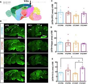 Immunostaining for p-tau in the brains of PS19 mice injected with CIT or STZ and PBS or AMY.